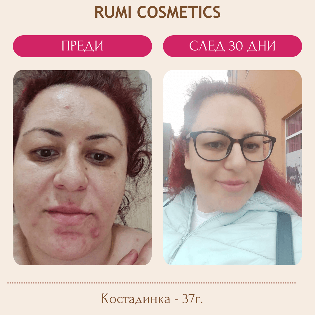 Rumi Минималистичен ритуал при акне - Унисекс парфюм 1мл - Сравни цени от 1 магазин с безплатна доставка